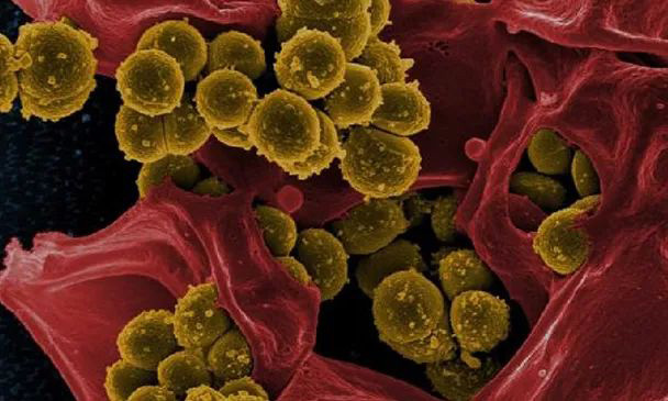 雪寶抗菌防霉板是什么?為什么要使用抗菌防霉板?